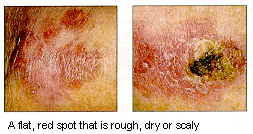cancer image cancer image